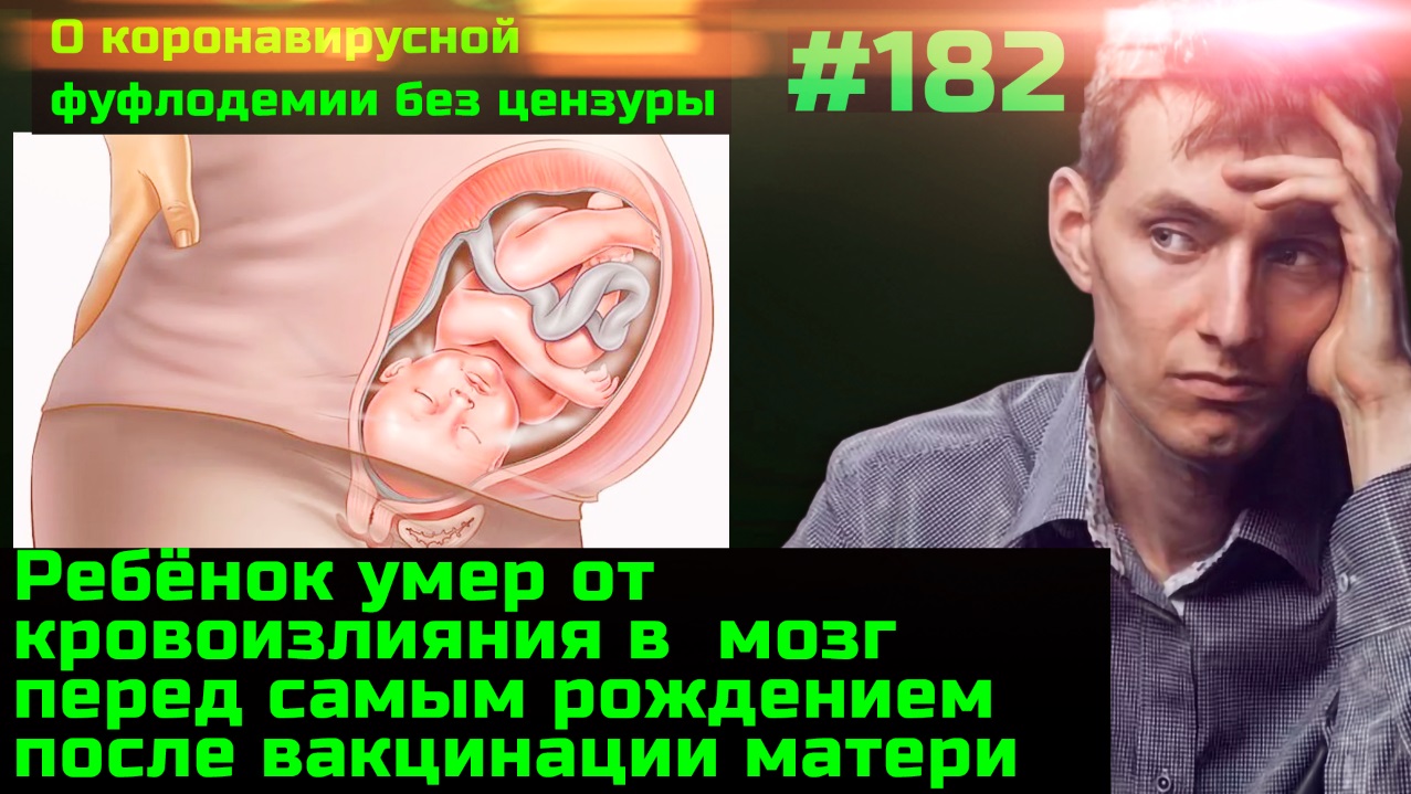 #182 Ребёнок умер перед рождением после вакцинации матери. Вакцинированному Козупице поплохело
