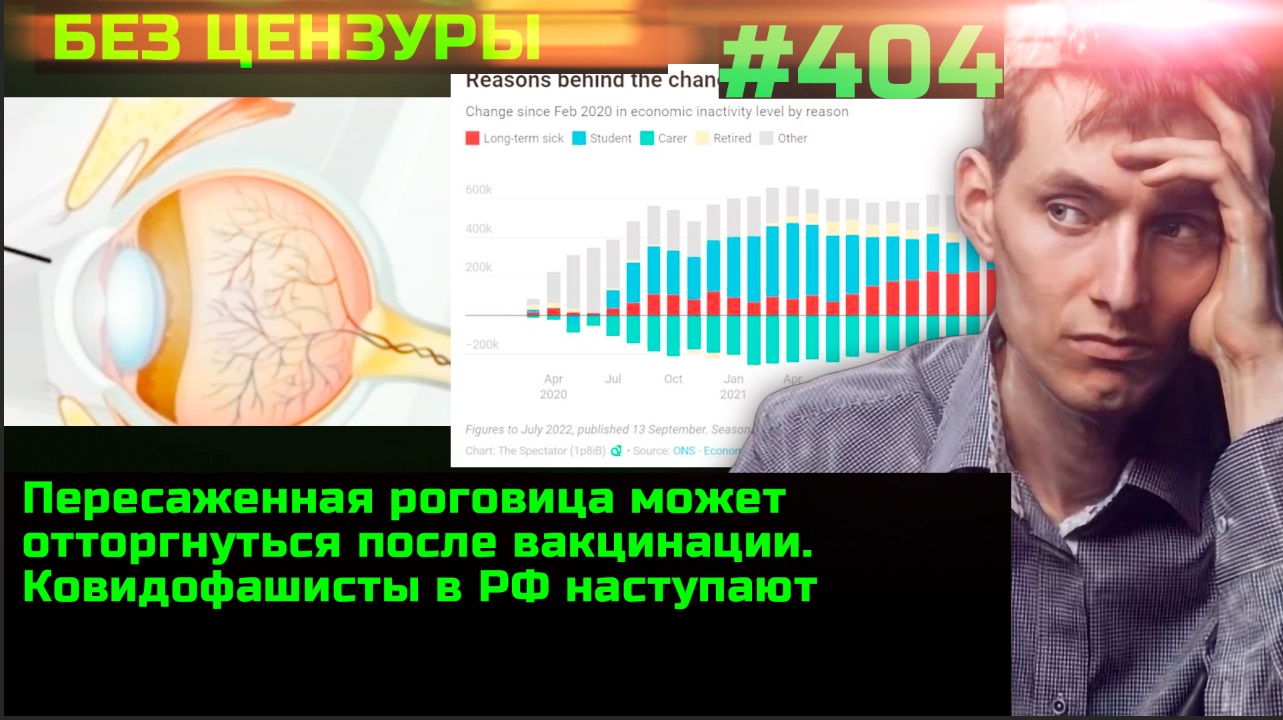 #404 Процент идиотов в РФ растёт. Отторжение трансплантата роговицы после вакцинации